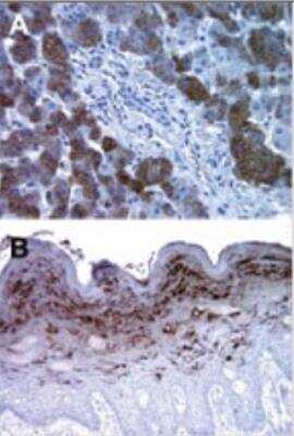 Immunohistochemistry-Paraffin: Bax inhibitor 1 Antibody (20F430) - Azide Free [NBP2-33264]