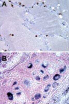Immunohistochemistry-Paraffin: Bax inhibitor 1 Antibody (20F430) - Azide Free [NBP2-33264]