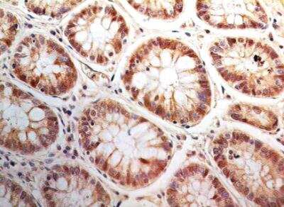 Immunohistochemistry-Paraffin: Bax inhibitor 1 Antibody (20F430) - Azide Free [NBP2-33264]