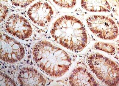 Immunohistochemistry-Paraffin: Bax inhibitor 1 Antibody (20F430) [NBP2-24919]