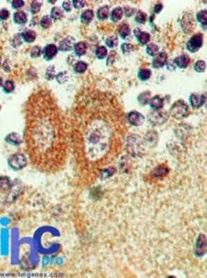 Immunohistochemistry-Paraffin: Bax inhibitor 1 Antibody (20F565) - Azide and BSA Free [NBP2-80591]