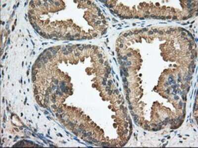 Immunohistochemistry: Bcl-10 Antibody (OTI4A8) - Azide and BSA Free [NBP2-71398]