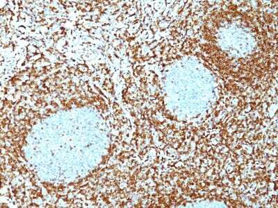 Immunohistochemistry-Paraffin: Bcl-2 Antibody (100/D5+124) [NBP2-34444]