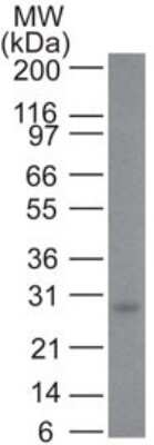 Western Blot: Bcl-2 Antibody (100/D5) [NBP2-15200]