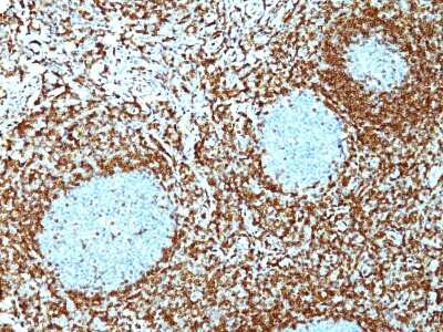 Immunohistochemistry-Paraffin: Bcl-2 Antibody (124) [NBP2-34443]