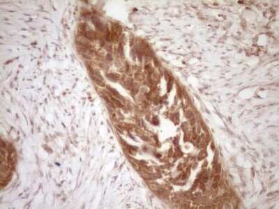 Immunohistochemistry: Bcl-2 Antibody (OTI9D3) [NBP2-46567]