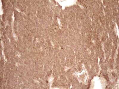 Immunohistochemistry: Bcl-2 Antibody (OTI9D3) [NBP2-46567]