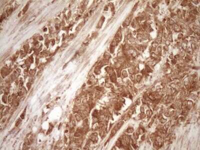 Immunohistochemistry: Bcl-2 Antibody (OTI9D3) [NBP2-46567]
