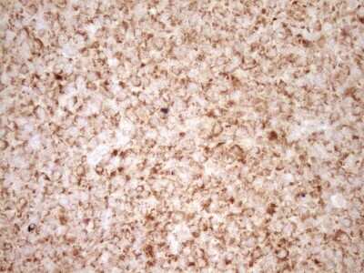Immunohistochemistry: Bcl-2 Antibody (OTI9D3) [NBP2-46567]
