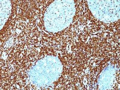 Immunohistochemistry-Paraffin: Bcl-2 Antibody (BCL2/782 + BCL2/796) - IHC-Prediluted [NBP2-48303]