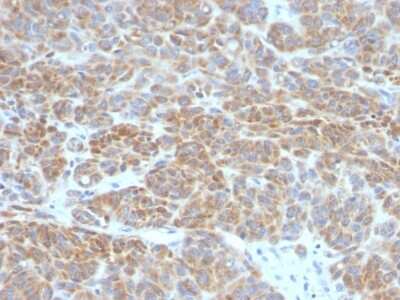 Immunohistochemistry-Paraffin: Bcl-2 Antibody (BCL2/782) [NBP2-44783]