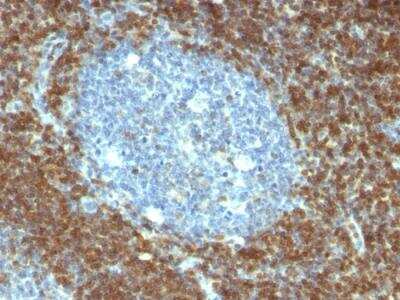 Immunohistochemistry-Paraffin: Bcl-2 Antibody (BCL2/796) - IHC-Prediluted [NBP2-48278]