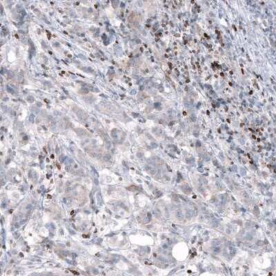 Immunohistochemistry-Paraffin: Bcl-2 Antibody (CL7935) [NBP2-88910]