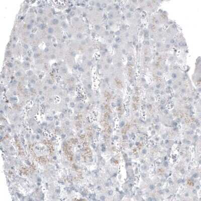 Immunohistochemistry-Paraffin: Bcl-2 Antibody (CL7935) [NBP2-88910]