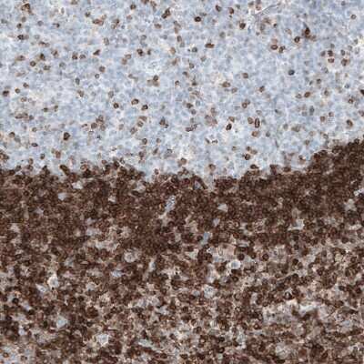Immunohistochemistry-Paraffin: Bcl-2 Antibody (CL7935) [NBP2-88910]