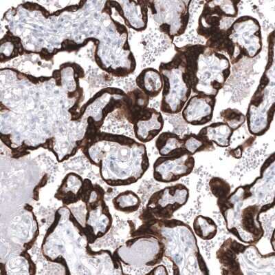 Immunohistochemistry-Paraffin: Bcl-2 Antibody (CL7935) [NBP2-88910]