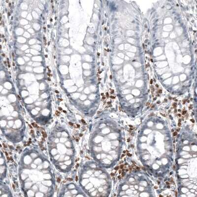Immunohistochemistry-Paraffin: Bcl-2 Antibody (CL7935) [NBP2-88910]