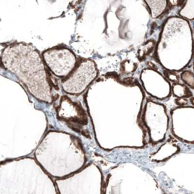 Immunohistochemistry-Paraffin: Bcl-2 Antibody (CL7935) [NBP2-88910]
