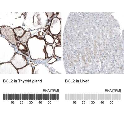 Immunohistochemistry-Paraffin: Bcl-2 Antibody (CL7935) [NBP2-88910]