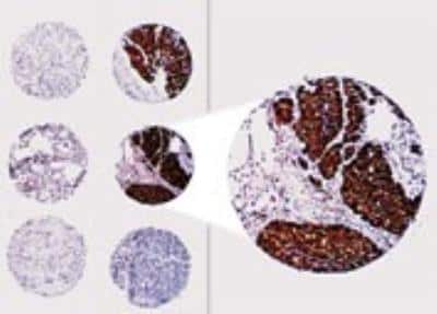 Immunohistochemistry-Paraffin: Bcl-2 Antibody [NB100-56102]
