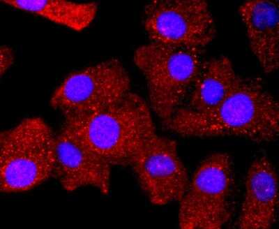 Immunocytochemistry/ Immunofluorescence: Bcl-2 Antibody (JF104-8) [NBP2-67182]