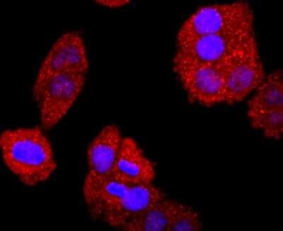 Immunocytochemistry/ Immunofluorescence: Bcl-2 Antibody (JF104-8) [NBP2-67182]