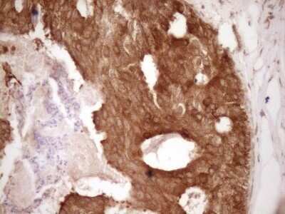 Immunohistochemistry: Bcl-2 Antibody (OTI9D3) - Azide and BSA Free [NBP2-70245]