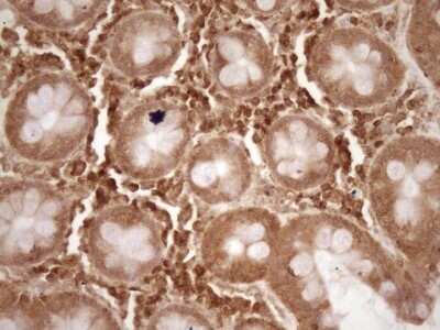 Immunohistochemistry: Bcl-2 Antibody (OTI9D3) - Azide and BSA Free [NBP2-70245]