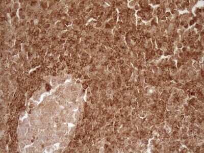 Immunohistochemistry: Bcl-2 Antibody (OTI9D3) - Azide and BSA Free [NBP2-70245]