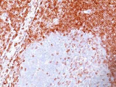 Immunohistochemistry-Paraffin: Bcl-2 Antibody (SPM117) - Azide and BSA Free [NBP2-34440]