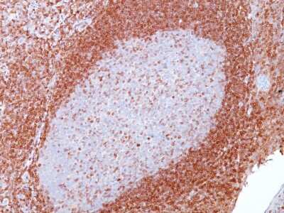 Immunohistochemistry-Paraffin: Bcl-2 Antibody (SPM117) [NBP2-34391]