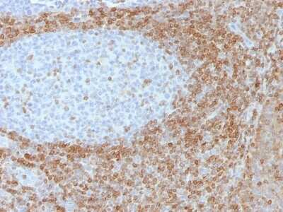 Immunohistochemistry-Paraffin: Bcl-2 Antibody (SPM530) - Azide and BSA Free [NBP2-34442]