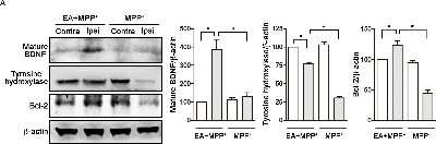 Western Blot: Bcl-2 Antibody [NB100-56098]