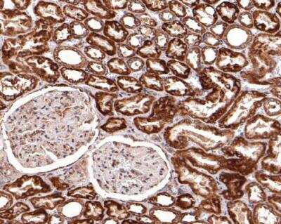 Immunohistochemistry-Paraffin: Bcl-2 related protein A1 Antibody (SC05-42) [NBP2-67563]