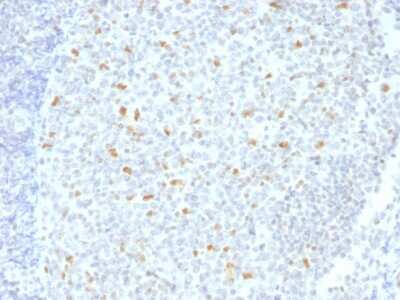 Immunohistochemistry-Paraffin: Bcl-6 Antibody (BCL6/1526) [NBP3-07527]