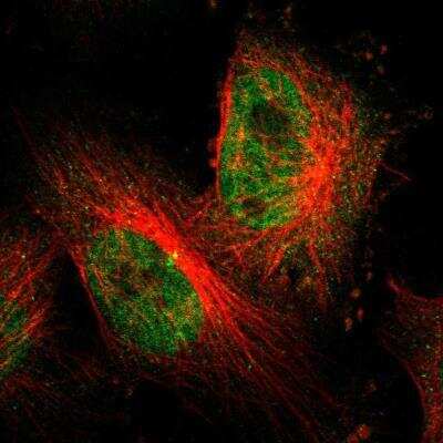 Immunocytochemistry/ Immunofluorescence: Bcl-6 Antibody [NBP2-59786]