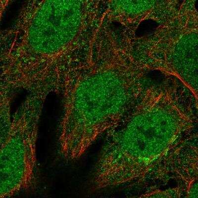 Immunocytochemistry/ Immunofluorescence: Bcl-6 Antibody [NBP2-76541]