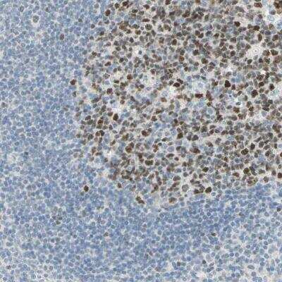 Immunohistochemistry-Paraffin: Bcl-6 Antibody [NBP2-59786]