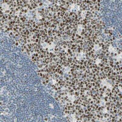 Immunohistochemistry-Paraffin: Bcl-6 Antibody [NBP2-59786]