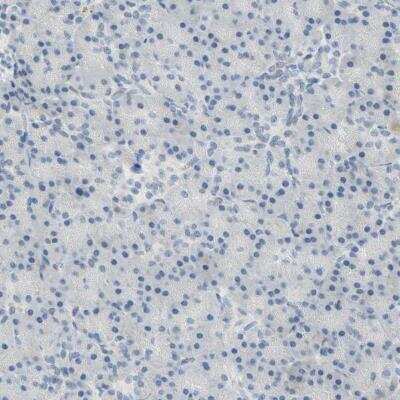 Immunohistochemistry-Paraffin: Bcl-6 Antibody [NBP2-59786]