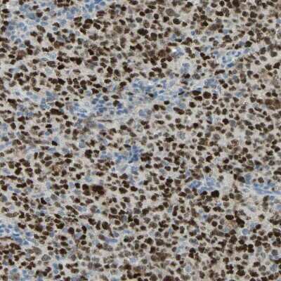 Immunohistochemistry-Paraffin: Bcl-6 Antibody [NBP2-59786]