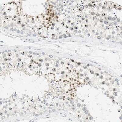 Immunohistochemistry-Paraffin: Bcl-6 Antibody [NBP2-59786]