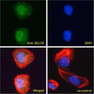Immunocytochemistry/ Immunofluorescence: Bcl 7A Antibody [NB100-769]