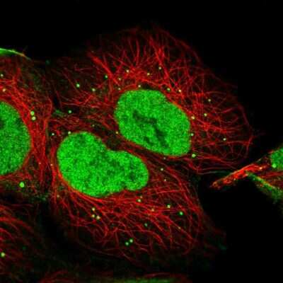 Immunocytochemistry/ Immunofluorescence: Bcl 7A Antibody [NBP1-91696]