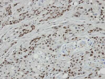 Immunohistochemistry-Paraffin: Bcl 7A Antibody [NBP1-30941]