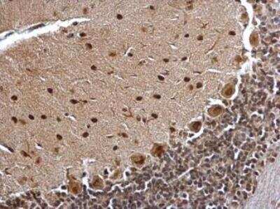 Immunohistochemistry-Paraffin: Bcl 7A Antibody [NBP1-30941]