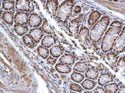 Immunohistochemistry-Paraffin: Bcl 7A Antibody [NBP1-30941]