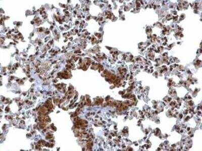 Immunohistochemistry-Paraffin: Bcl 7A Antibody [NBP1-30941]