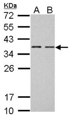 Western Blot: Bcl 7A Antibody [NBP1-30941]