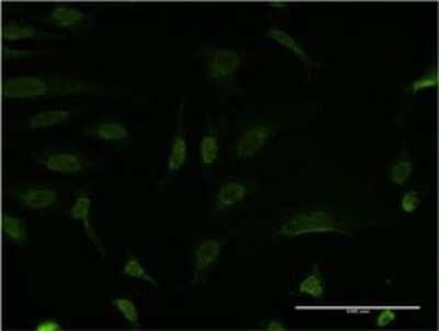 Immunocytochemistry/ Immunofluorescence: Bcl-9 Antibody (1A2) [H00000607-M02]